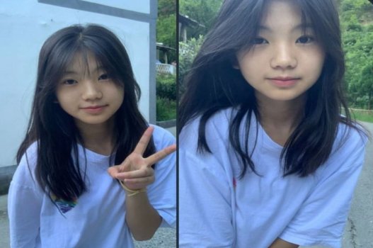 Bím trẻ ẩm ướt đầy khi khạc